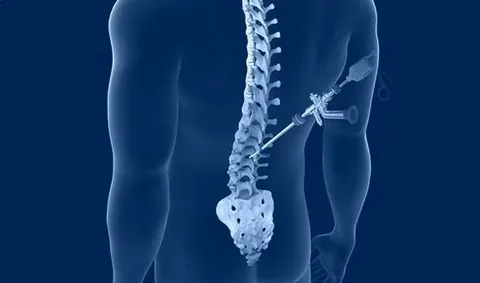 Minimally Invasive Spine Surgery